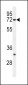 HRD1 Antibody (N-term)